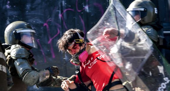 RepresioĚn-Chile-herido-580x312