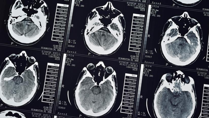 cerebro
